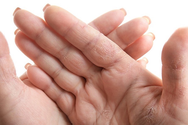 Người tiêu dùng sử dụng gel rửa tay dưỡng da tránh tình trạng khô da tay